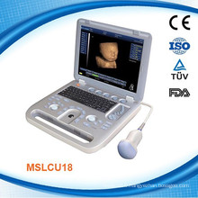 MSLCU18K CE ISO13485 approved 4D Digital Ultrasound Machine /scanner Color Doppler with DICOM 3.0
